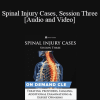 Trial Guides - Spinal Injury Cases